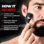 Derma Roller for Facial Body Hair Growth